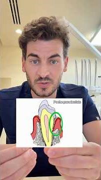 Un traitement moderne et non invasif est indispensable pour un premier traitement de parodontite