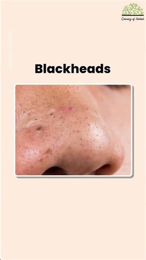 Stop Using the Wrong Serum ❌ | Best Serum for Every Skin Problem