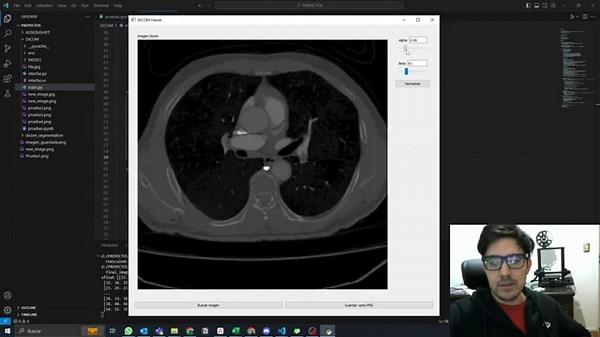 Visualizador de imágenes DICOM en Python