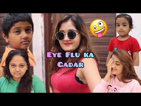 EYE FLU hua & ghar me go gaya Hungama Father Saab & Chiku Baby ki full Funny Comedy Bindass Kavya