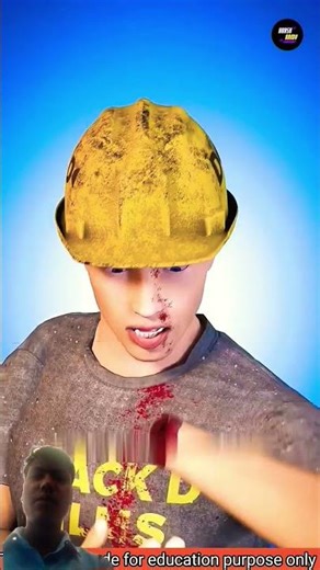 What To Do If You Cut Your Hand 😲😨 || #shorts #handinjury #injurycare