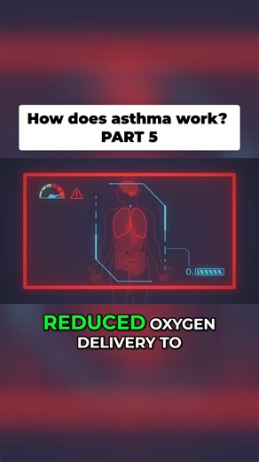 MindBodyBoostr on Instagram: "How does asthma work? PART 5 original video: TED-Ed #Asthma #AsthmaAttack #RespiratoryHealth #Breathing #HealthTips #MedicalFacts #LungHealth"