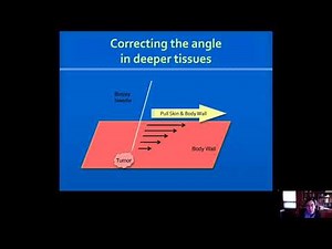 Abdominal Biopsies & Drainages: Tips and Techniques