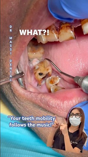 “Your teeth mobility follows the music!”