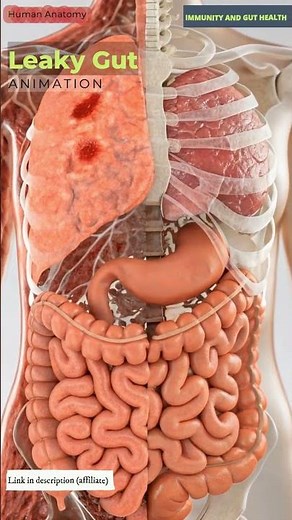 Leaky Gut Animation | Digestive System | Immunity and Gut Health | 01