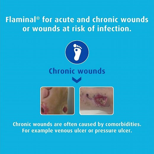 Flaminal® - Treatment for Acute and Chronic Wounds