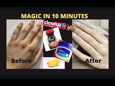 How to lighten hands & remove DARK KNUCKLES instantly|DIY skin whitening HomeRemedies|100% EFFECTIVE