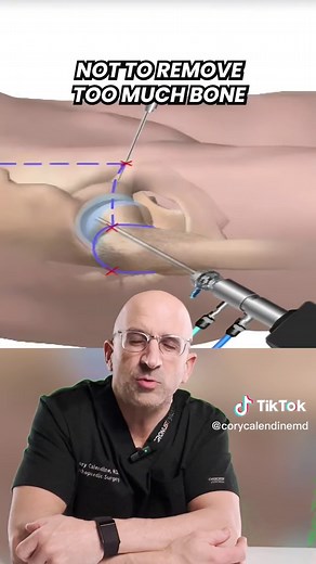Understanding Femoroacetabular Impingement: Symptoms, Diagnosis, and Treatment Options