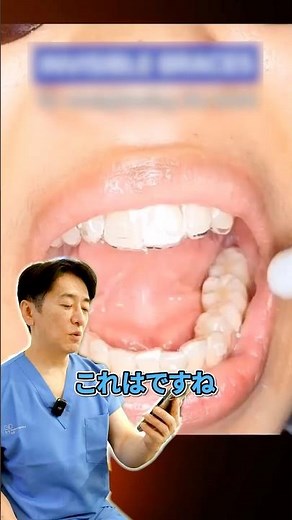 マウスピース矯正の仕組みを歯科医が解説！ #審美歯科 #歯列矯正 #マウスピース矯正 #インビザライン #歯医者