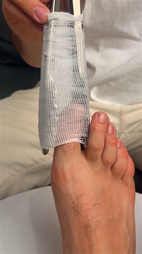 How to bandage foot toes easily #simple #toes #bandage