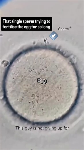 World of Biology on Instagram: "Real time video of a single sperm, trying very hard to fertilise the egg. The process of reproduction is very interesting. Millions of sperm travelled through innumerable difficulties to reach one egg and then try very hard to fertilise that egg, but the egg is a tough cookie. It only allows sperm to get in and fertilise it and especially only one particular sperm for the process of fertilisation, whether it’s natural or IVF and that is why the process of pregnanc