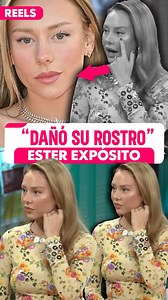 Ester Exposito Daño su Rostro, Impactante Cambio genera Controversia #esterexposito #esterexpositocirugias #esterexpositoentrevista | José Alvarado