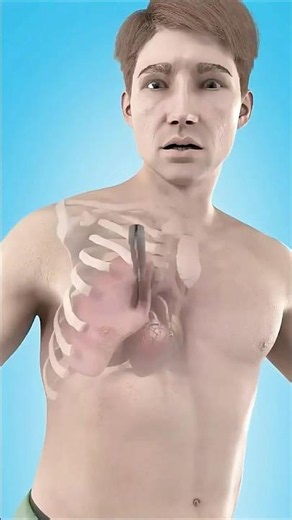 Imagine you're walking down the street and this happens, how do you react quickly? #DrMostafa #re...