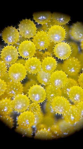 Hibiscus pollen grains magnified! The spines on the surface of each grain are referred to as the “echinate” pattern. The spines allow pollen grains to adhere easily onto the insect’s body and its tiny hair-like structures (setae) to transfer them to the female flower/parts. These spines can also be found on pollen grains from the sunflower family (Asteraceae), the Morning Glory family, which includes Sweet potato (Convolvulaceae), Mallow (Malvaceae), and some of the members in the gourd family (
