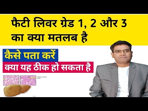Fatty liver grade 1, 2 and 3 Means? what are Symptoms and is it Curable or Treatable