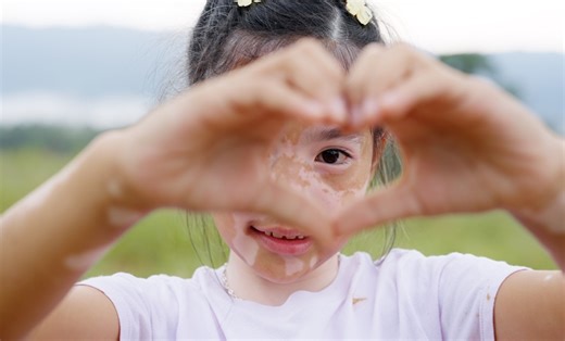 A New Practical Approach in Paediatric Atopic Dermatitis