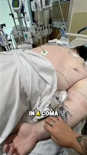 My experience after a coma. And bench press. #shorts #benchpress #recovery #gym #lifting