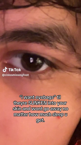 Understanding Sunken Eye Bags: Causes and Solutions