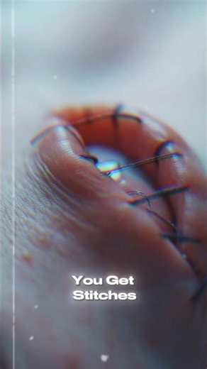 The SCIENCE of Skin Healing After Stitches