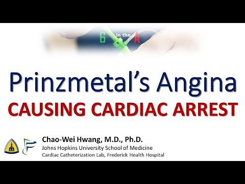 Prinzmetal's Angina causing Cardiac Arrest