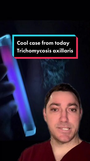 Understanding Trichomycosis: Dermatologist's Insights