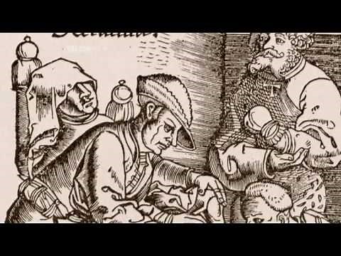 02 - Surgery - Leeches