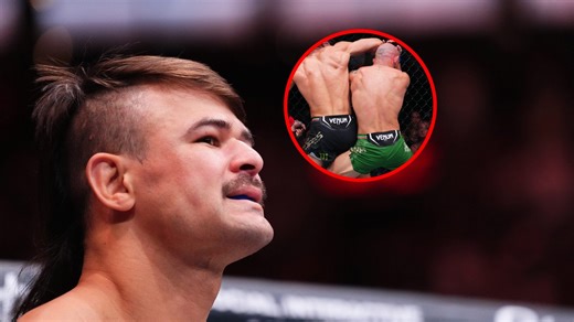 Diego Lopes shares proof spinning elbow KO over Jean Silva wasn’t a fluke at Noche UFC