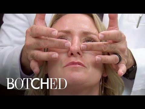 Woman's Nose Bones Are Straight--But Cartilage Is Crooked | Botched | E!