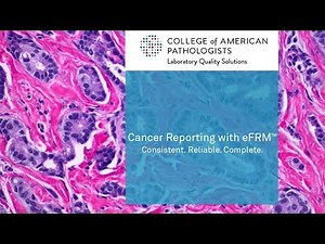Cancer Reporting with eFRM