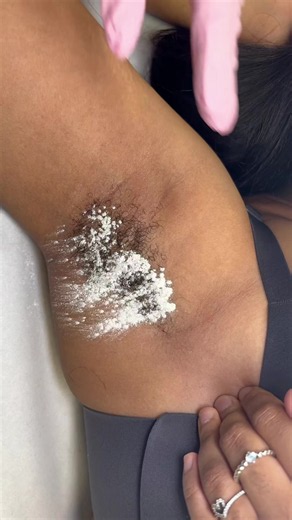 Waxing hair removal: tips for excessive hairs