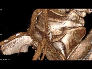 3D VR movie creator in RadiAnt DICOM Viewer