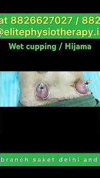 What is Cupping therapy | hijama | wet cupping | Benefits of cupping therapy