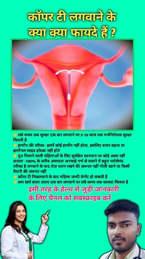 कॉपर टी लगवाने के क्या क्या फायदे हैं ? Benefits of IUD Copper Tube #viral #coppertube #pregnancy