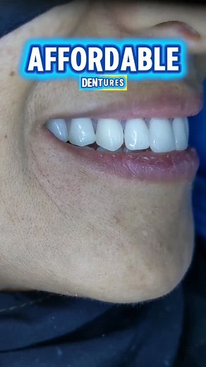 Maganda at Murang Dentures 💎 CORRECTIVE DENTISTRY 💎 Using 💎 CONSERVATIVE DENTISTRY 💎 1. Bakit ganito ang kulay ng ngipin ko? 2. Bakit laging nalalaglag ang fixtures ko? 3. May pag-asa ba pa ang teeth ko? 4. Ayoko ng jacket crowns. May iba pa ba? 5. I need to change my smile. 6. Gusto ko lang natural white lang. 7. Takot ako sa dentista. 8. Takot ako magpabunot. 9.Paano ba hindi matanggal ang VENEERS ko? 10. Paano magkakasya ang budget ko? CORRECTIVE DENTISTRY helps us figure out your concern