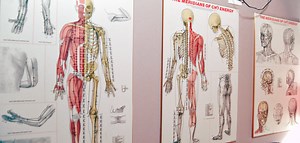 L'acupuncture • Fiv.fr