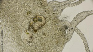 in the body of the hydra, digestive enzymes break down the food caught by the Bosmia crab, and the remainders of food go through the mouth, under a microscope
