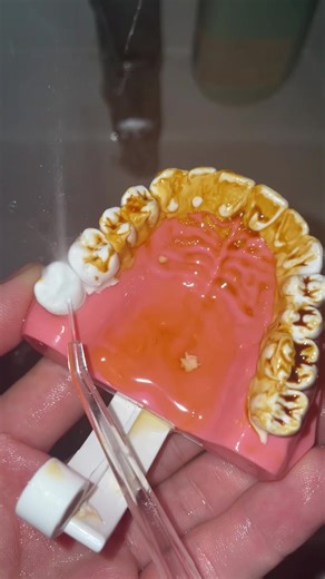 The Benefits of Oral Water Flossing