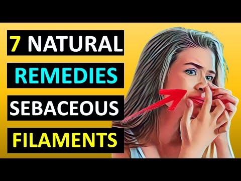 How to Get Rid of Sebaceous Filaments Naturally Using Home Remedies
