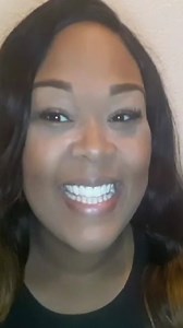 1.4K views | Summer Smile - use code ''SUMMERSMILE' for 10% off + extra 15% Discount with selected payment methods. Find out more here  https://bit.ly/2NJ2O3W 醴Classic, BL1 | instasmile | Facebook