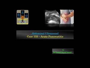 Ultrasound Case 133 - Acute Pancreatitis