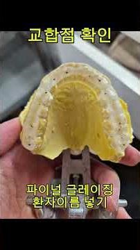 갑자기 턱관절 환자가 늘어난건지...환저 이름 넣기 #3shape #cadcam #3dprint #splint #clear