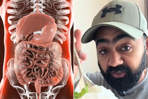 Colon cancer: GP shares four dietary staples he eats 'every single day' to cut his risk of the disease