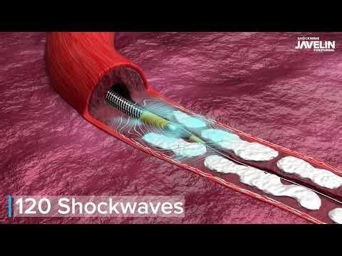 Shockwave Javelin Product Video (International)