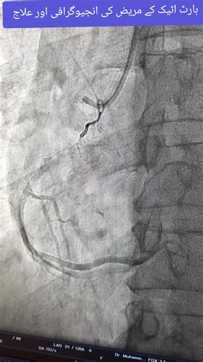 #drabubakarmaqbool #fpyシ #fyp #foryou #foryoupage