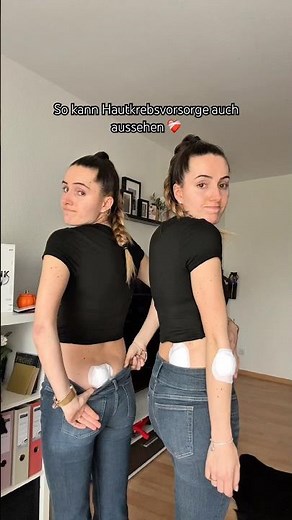 Ja, so kann Vorsorge auch aussehen 🙏🏼 #vorsorge #hautkrebsvorsorge #operation