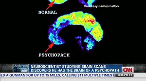 Dr. Fallon: Psychopaths can't change