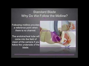 King Vision In-Service Guide Video