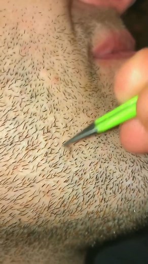 Removal my husband beard pili multigemini ✌️💕#multigemini6 | Nicholas Delacruz