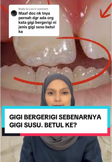 Gigi Bergerigi: Perbezaan Gigi Susu dan Gigi Kekal