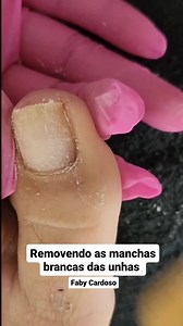 Como retirar as manchas brancas utilizando o óleo da...Ver Mais | Faby Cursos de Unhas